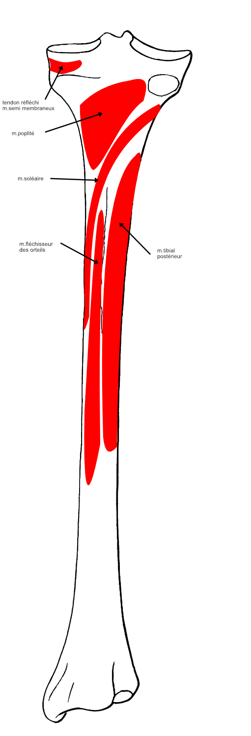  insertions dorsales 