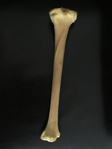  tibia: vue dorsale 