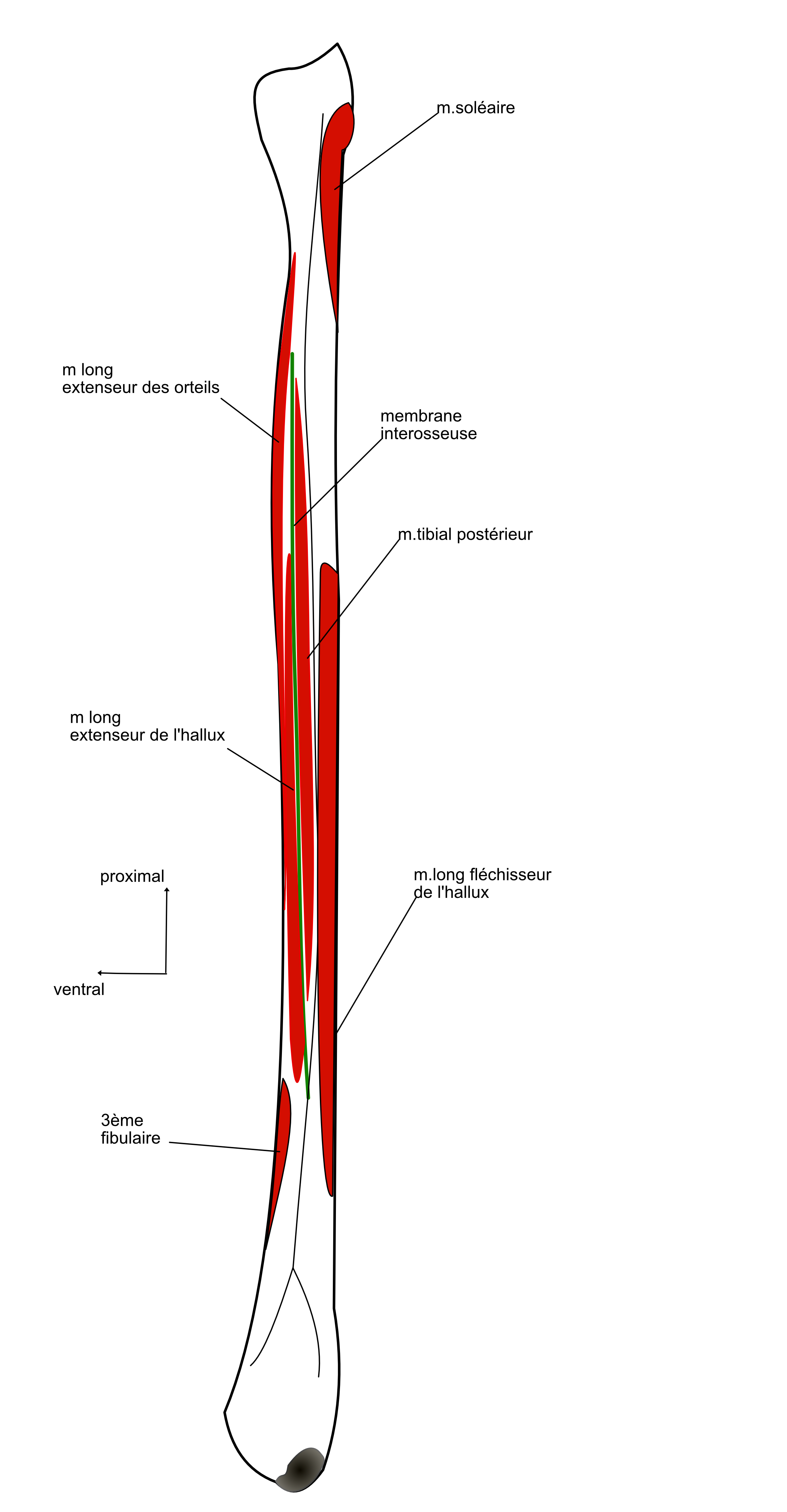  insertions latérales 