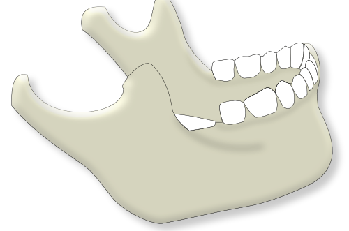 mandibule: vue générale