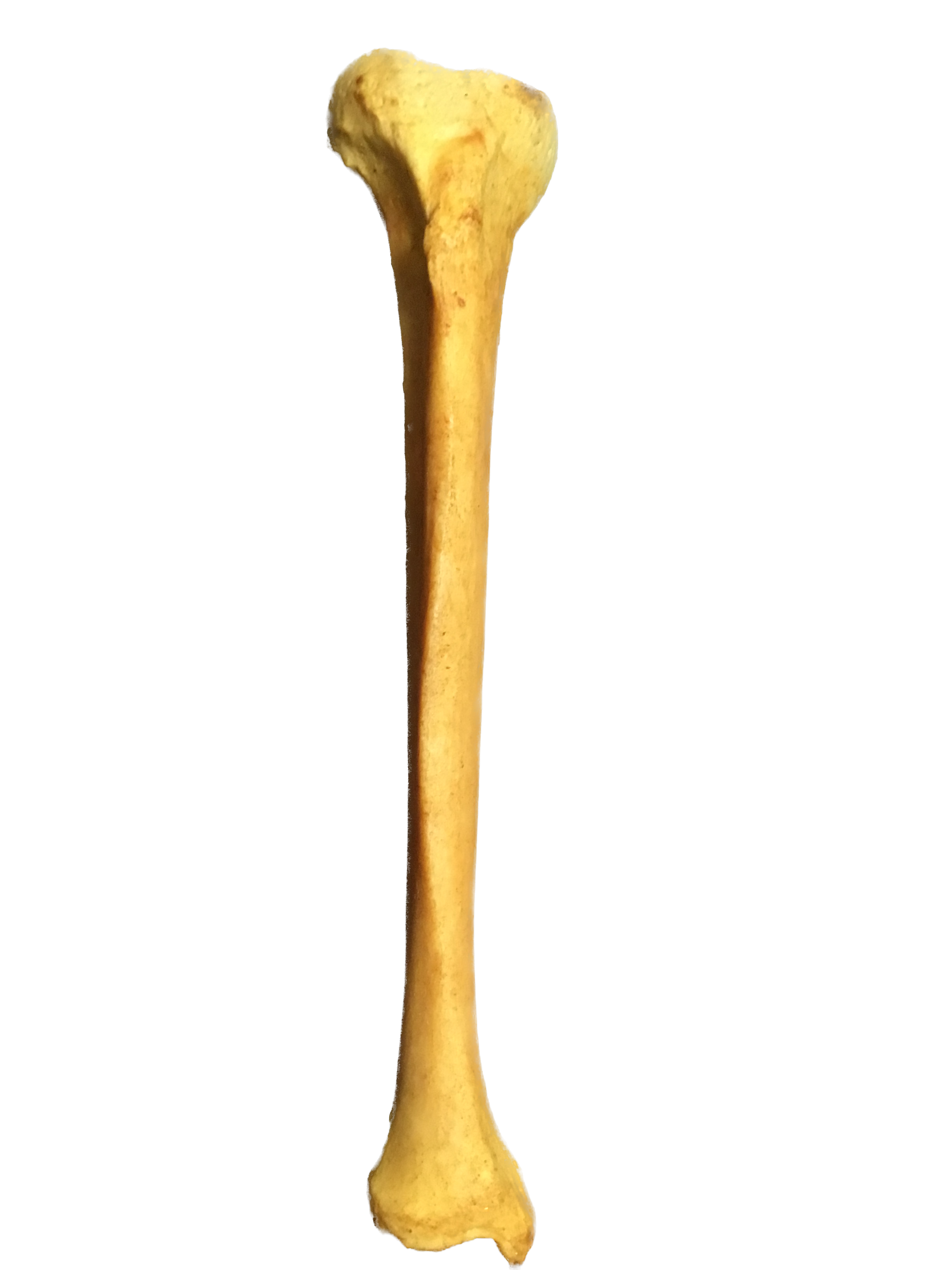  vue ventrale du tibia