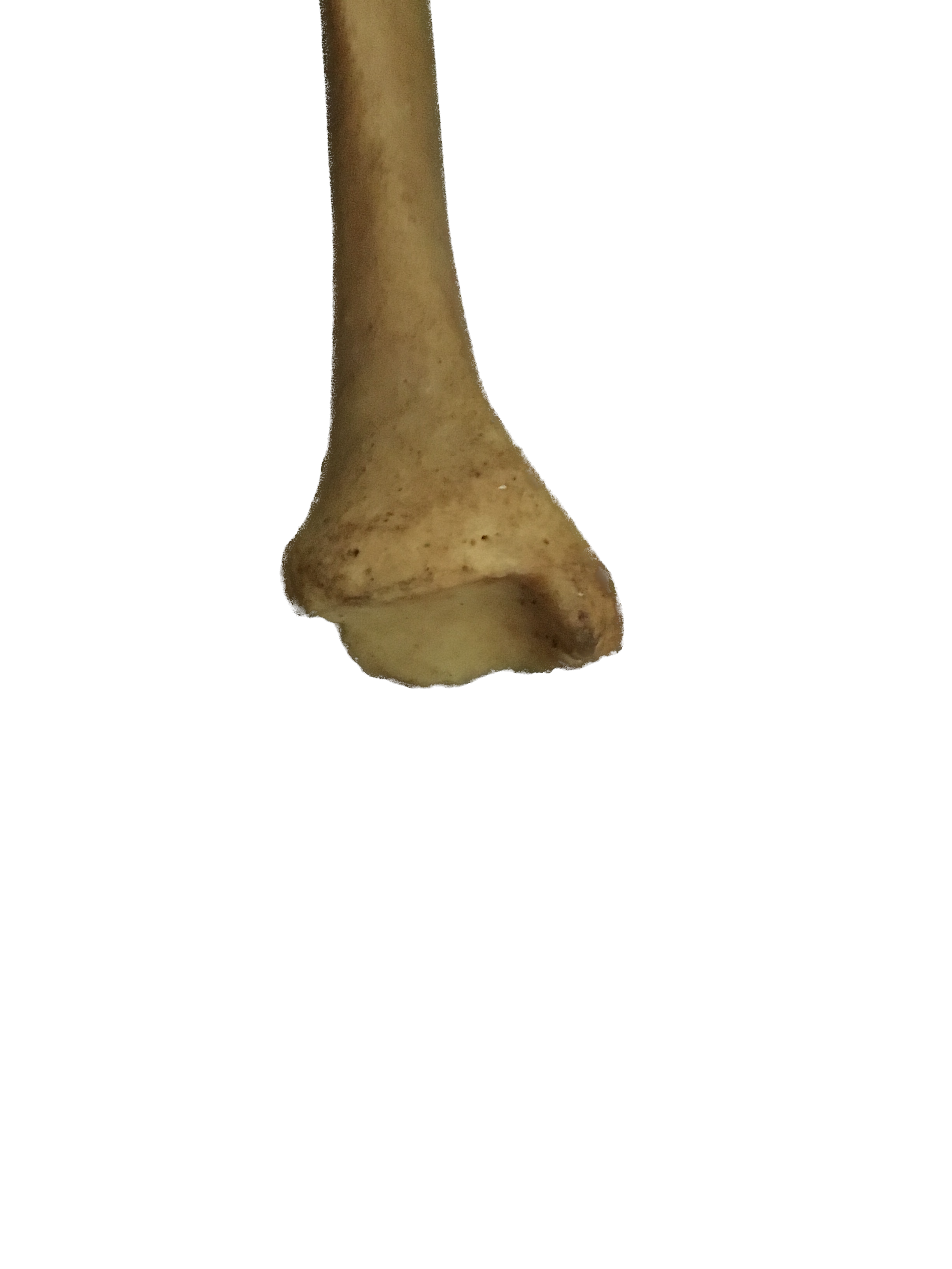 épiphyse distale du tibia