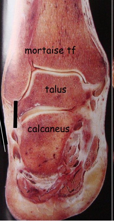 coupe de la cheville